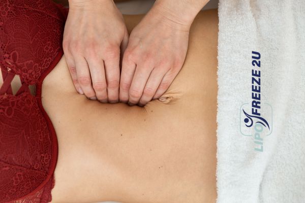 diastasis recti treatment Kings Langley