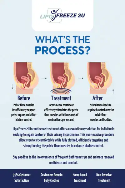 Diagram of how incontinence treatment Kings Langley works.