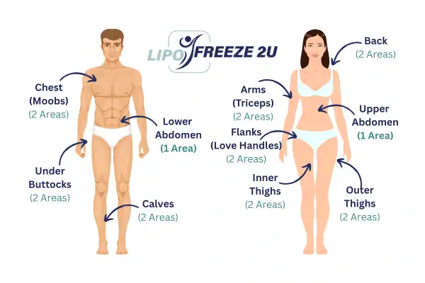 Areas you can have fat freezing treatment Kings Langley