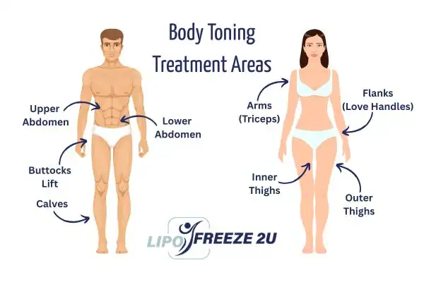 Graphic showing where you can have Body toning Treatment Kings Langley on your body