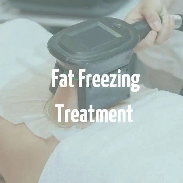 fat freezing treatment Kings Langley