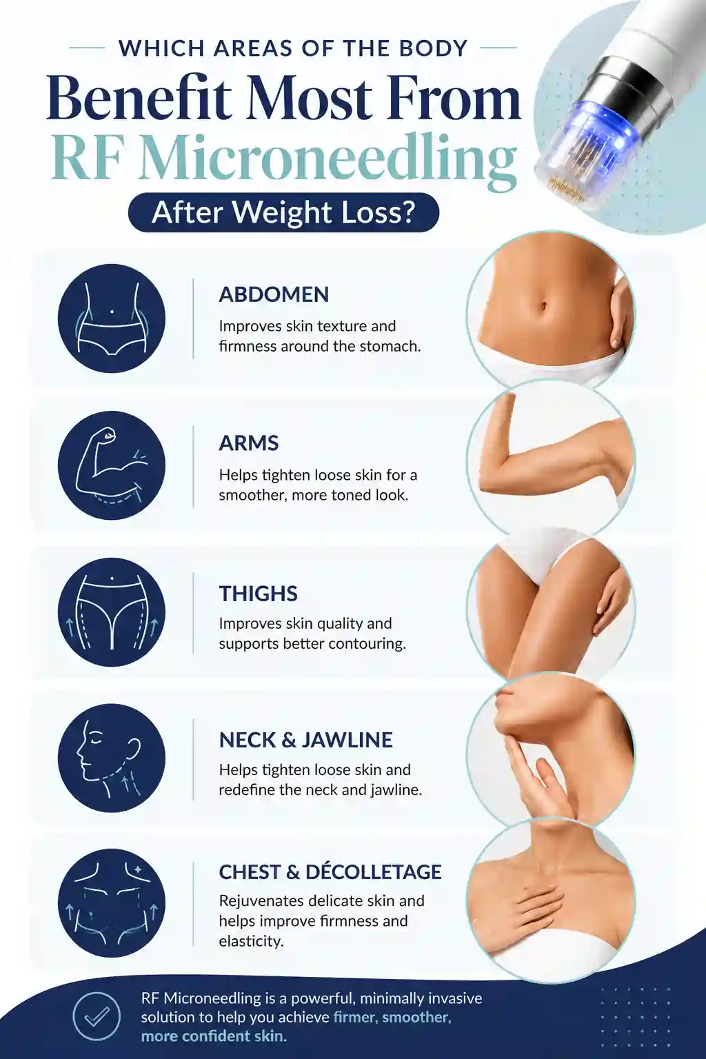 Which Areas of the Body Benefit Most From RF Microneedling After Weight Loss Kings Langley